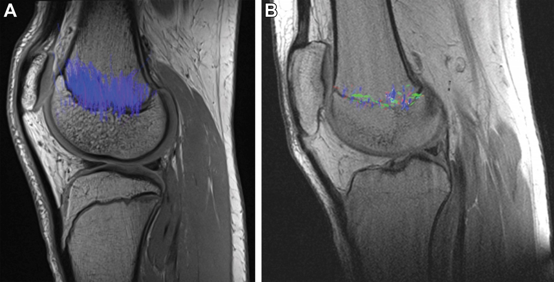 Sagittal knee MR images